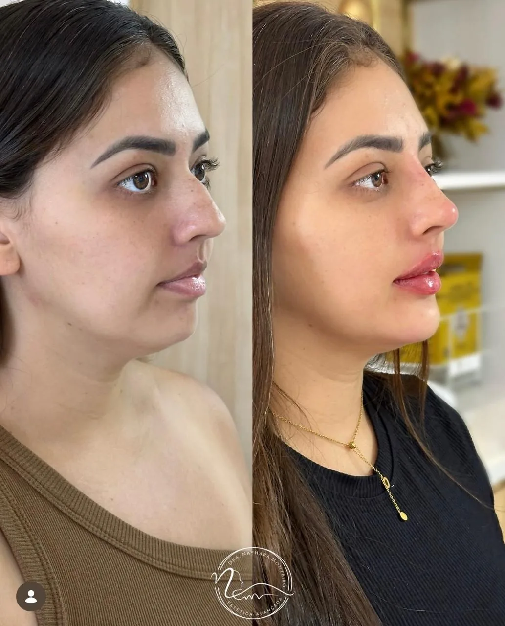 Resultado de tratamento Perfil dos sonhos 1