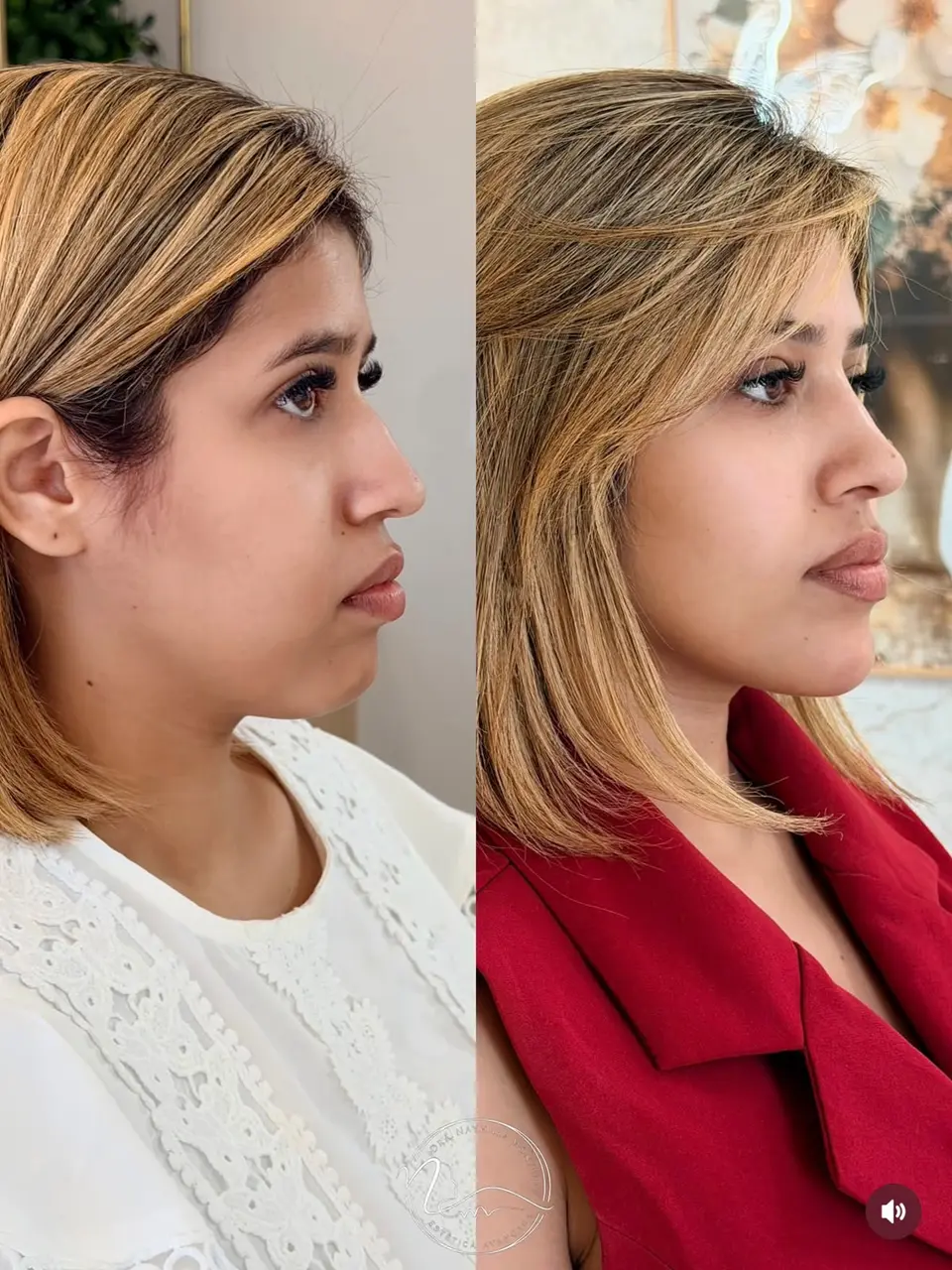 Resultado de tratamento Perfil dos sonhos 2