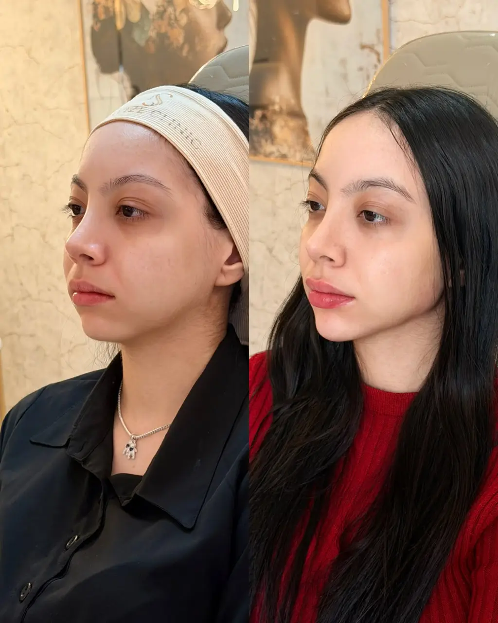 Resultado de tratamento Perfil dos sonhos 3
