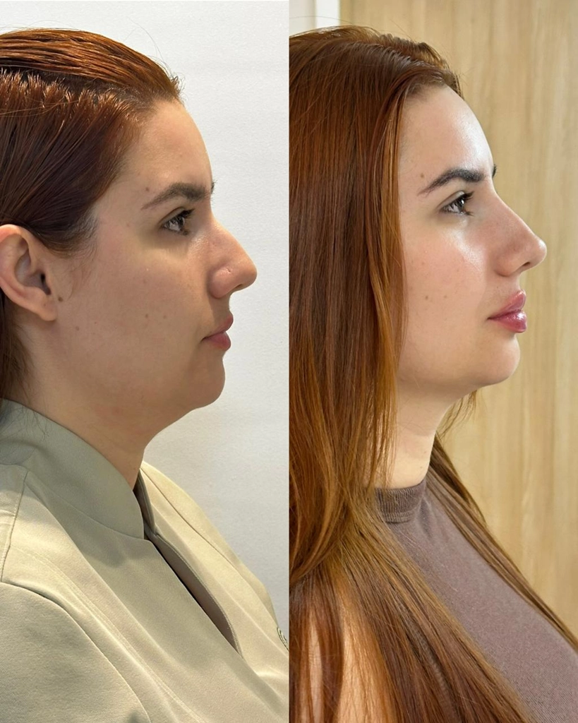 Resultado de tratamento Perfil dos sonhos 4