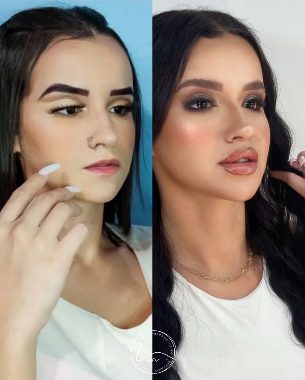 Resultado de tratamento Posicionamento de imagem 1