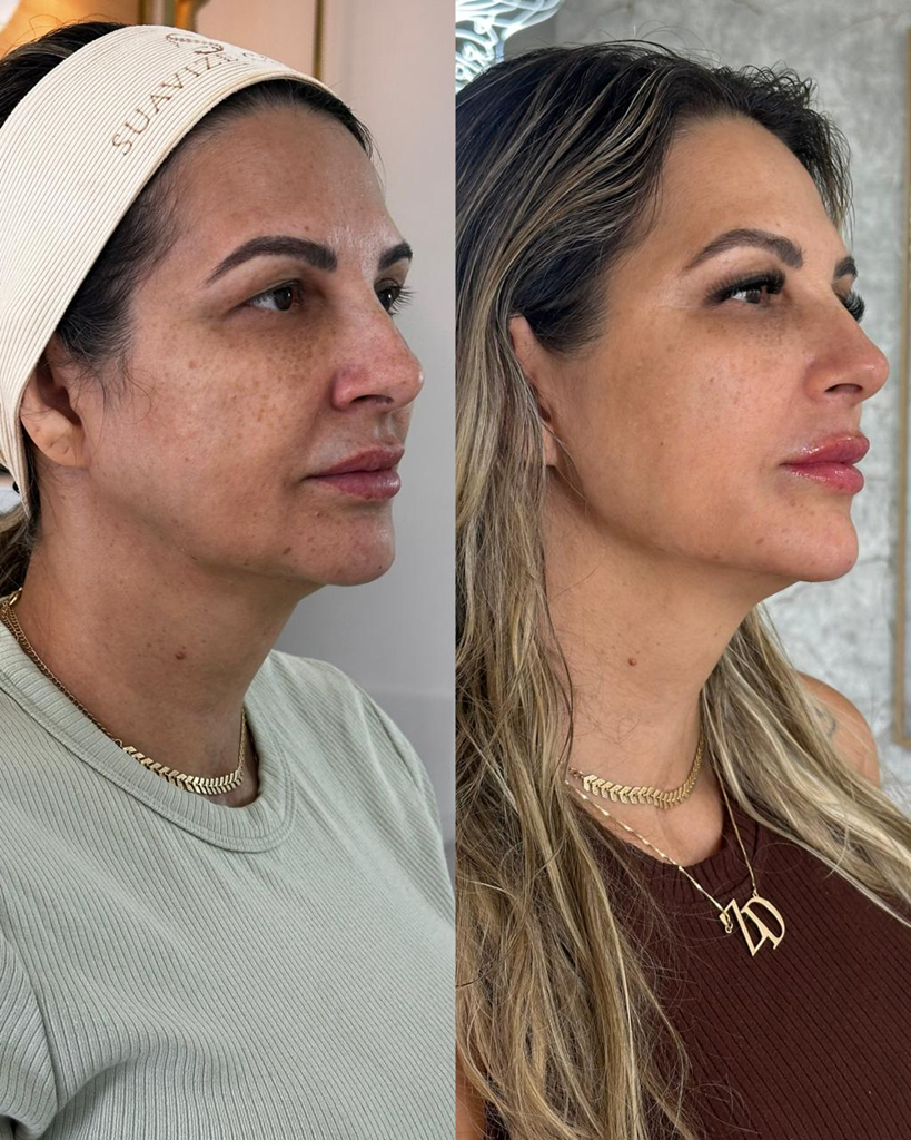 Resultado de tratamento Posicionamento de imagem 3
