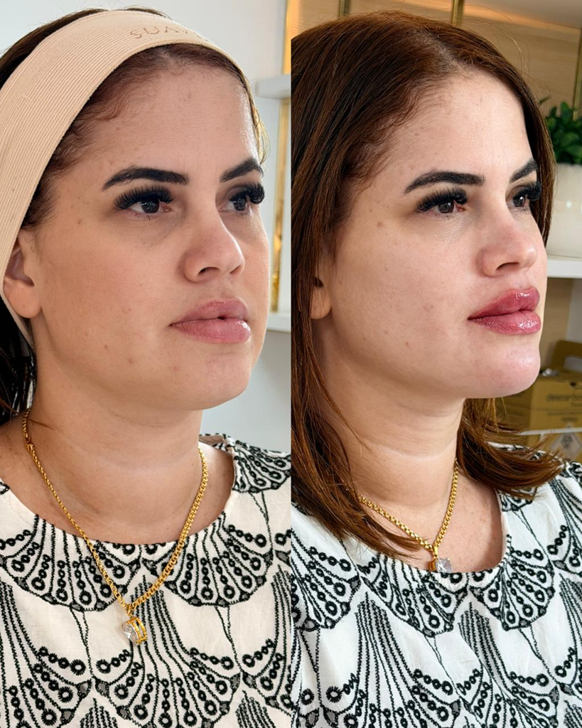 Resultado de tratamento Posicionamento de imagem 4